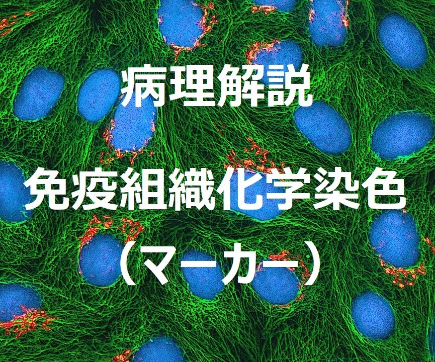 免疫組織化学はどのように機能しますか?